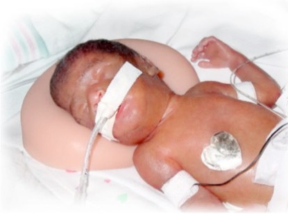 Cinis Preemie Halo